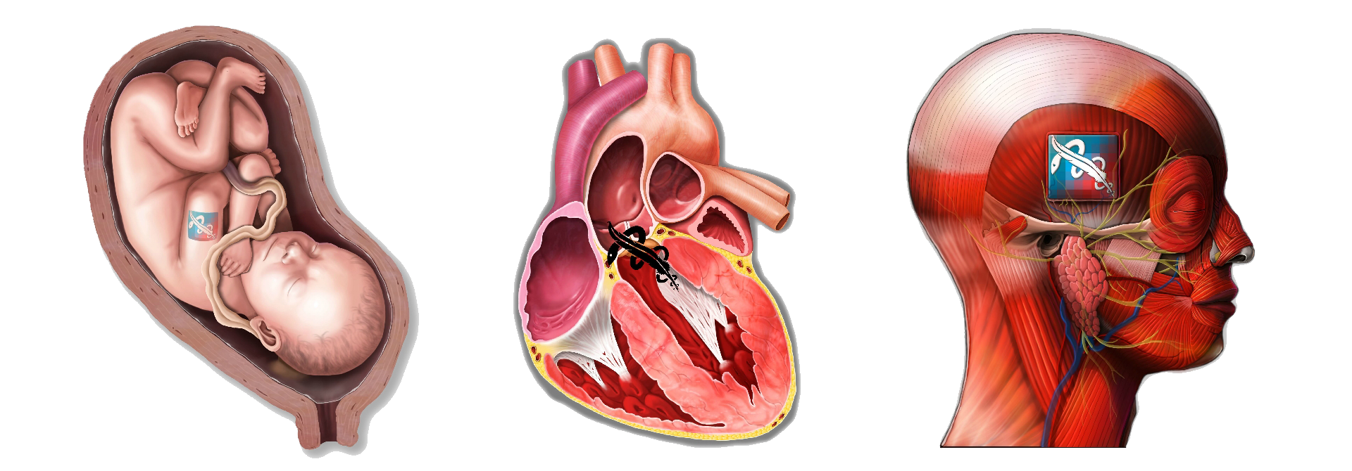 Collection of medical illustrations by Kai Jiong Li including surgical procedures, anatomical diagrams, and graphical abstracts for peer-reviewed journals