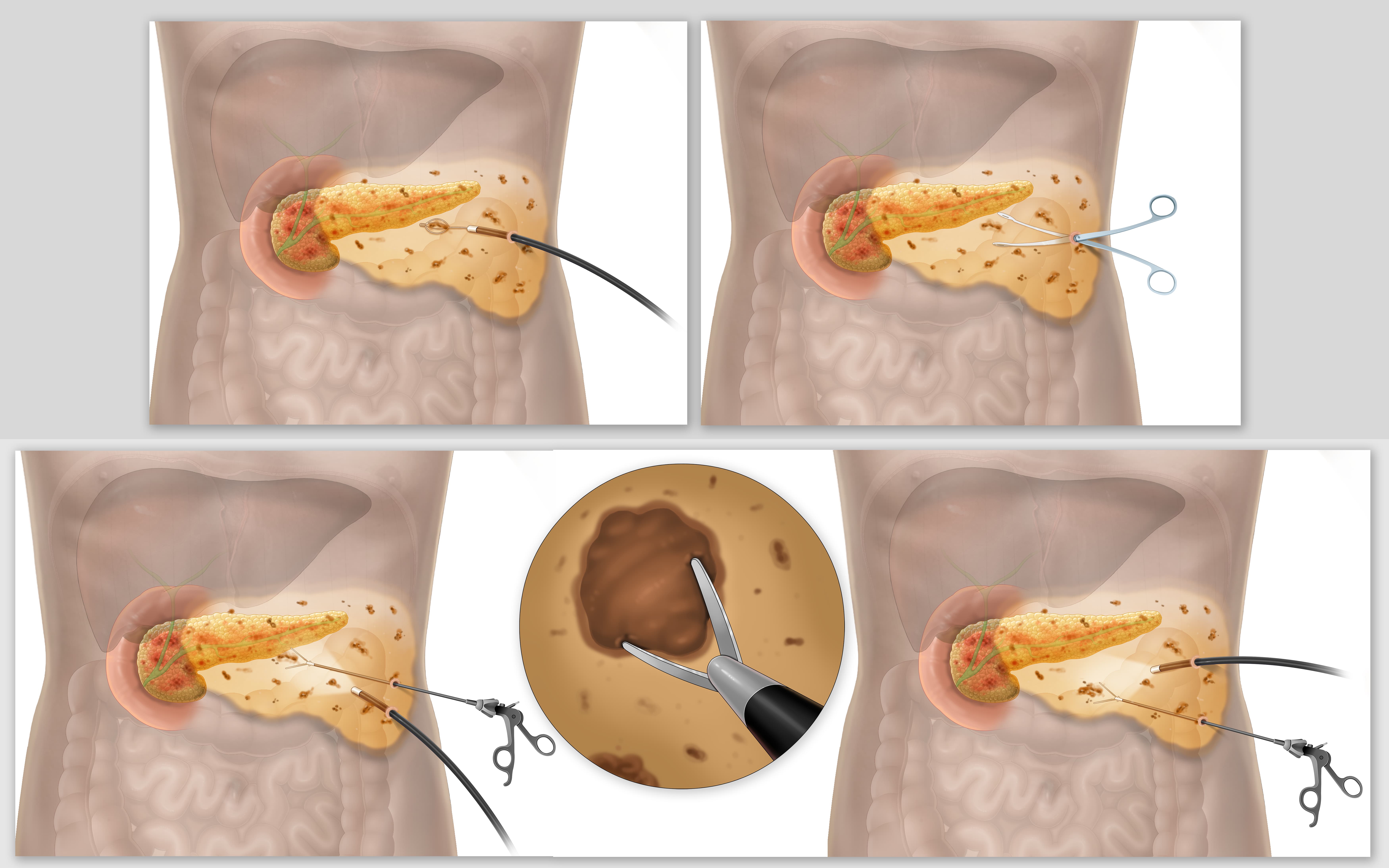 Procedure Visualization